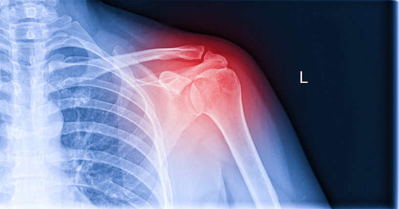 Shoulder and rotator cuff damage